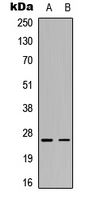 Western blot analysis of C1QG expression in Hela (A); rat muscle (B) whole cell lysates.
