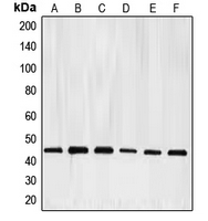 Western blot analysis of E2F4 expression in HeLa (A); K562 (B); Jurkat (C); Raji (D); A431 (E); mouse kidney (F) whole cell lysates.