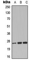 Western blot analysis of CLIC3 expression in K562 (A); rat brain (B); rat lung (C) whole cell lysates.