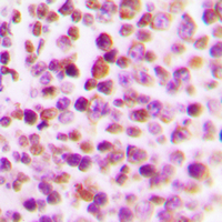 Immunohistochemical analysis of E2F4 staining in human tonsil formalin fixed paraffin embedded tissue section. The section was pre-treated using heat mediated antigen retrieval with sodium citrate buffer (pH 6.0). The section was then incubated with the antibody at room temperature and detected using an HRP conjugated compact polymer system. DAB was used as the chromogen. The section was then counterstained with haematoxylin and mounted with DPX.