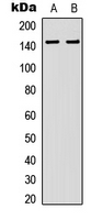 Western blot analysis of DGK kappa expression in human lung (A); rat kidney (B) whole cell lysates.
