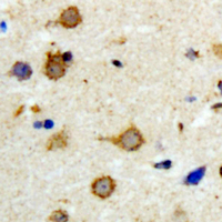 Immunohistochemical analysis of DGK kappa staining in human brain formalin fixed paraffin embedded tissue section. The section was pre-treated using heat mediated antigen retrieval with sodium citrate buffer (pH 6.0). The section was then incubated with the antibody at room temperature and detected using an HRP conjugated compact polymer system. DAB was used as the chromogen. The section was then counterstained with haematoxylin and mounted with DPX.