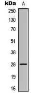 Western blot analysis of ELOVL5 expression in Hela (A) whole cell lysates.