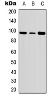 Western blot analysis of c-FER (pY402) expression in HeLa (A); Jurkat (B); NIH3T3 (C) whole cell lysates.