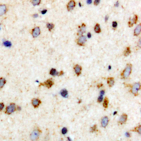 Immunohistochemical analysis of c-FER (pY402) staining in human brain formalin fixed paraffin embedded tissue section. The section was pre-treated using heat mediated antigen retrieval with sodium citrate buffer (pH 6.0). The section was then incubated with the antibody at room temperature and detected using an HRP conjugated compact polymer system. DAB was used as the chromogen. The section was then counterstained with haematoxylin and mounted with DPX.
