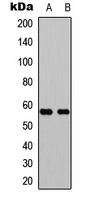 Western blot analysis of GPR101 expression in Jurkat (A); rat muscle (B) whole cell lysates.