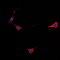 Immunofluorescent analysis of GPR101 staining in Jurkat cells. Formalin-fixed cells were permeabilized with 0.1% Triton X-100 in TBS for 5-10 minutes and blocked with 3% BSA-PBS for 30 minutes at room temperature. Cells were probed with the primary antibody in 3% BSA-PBS and incubated overnight at 4 ��C in a hidified chamber. Cells were washed with PBST and incubated with a DyLight 594-conjugated secondary antibody (red) in PBS at room temperature in the dark. DAPI was used to stain the cell nuclei (blue).