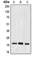 Western blot analysis of Ephrin A2 expression in HepG2 (A); mouse liver (B); rat kidney (C) whole cell lysates.