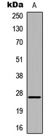 Western blot analysis of HOXA6 expression in K562 (A) whole cell lysates.