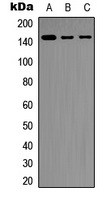Western blot analysis of SHIP1 expression in Raji (A); THP1 (B); NIH3T3 (C) whole cell lysates.