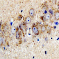 Immunohistochemical analysis of Kir3.1 (pS185) staining in human brain formalin fixed paraffin embedded tissue section. The section was pre-treated using heat mediated antigen retrieval with sodium citrate buffer (pH 6.0). The section was then incubated with the antibody at room temperature and detected using an HRP conjugated compact polymer system. DAB was used as the chromogen. The section was then counterstained with haematoxylin and mounted with DPX.