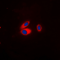 Immunofluorescent analysis of Kir3.1 (pS185) staining in A549 cells. Formalin-fixed cells were permeabilized with 0.1% Triton X-100 in TBS for 5-10 minutes and blocked with 3% BSA-PBS for 30 minutes at room temperature. Cells were probed with the primary antibody in 3% BSA-PBS and incubated overnight at 4 deg C in a hidified chamber. Cells were washed with PBST and incubated with a DyLight 594-conjugated secondary antibody (red) in PBS at room temperature in the dark. DAPI was used to stain the cell nuclei (blue).