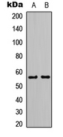 Western blot analysis of Kir3.1 expression in K562 (A); NIH-3T3 (B) whole cell lysates.