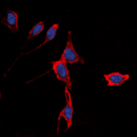 Immunofluorescent analysis of Kir3.1 staining in K562 cells. Formalin-fixed cells were permeabilized with 0.1% Triton X-100 in TBS for 5-10 minutes and blocked with 3% BSA-PBS for 30 minutes at room temperature. Cells were probed with the primary antibody in 3% BSA-PBS and incubated overnight at 4 deg C in a hidified chamber. Cells were washed with PBST and incubated with a DyLight 594-conjugated secondary antibody (red) in PBS at room temperature in the dark. DAPI was used to stain the cell nuclei (blue).