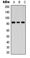 Western blot analysis of KIF2C (pS95) expression in Jurkat (A); A431 (B); HepG2 (C) whole cell lysates.