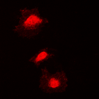 Immunofluorescent analysis of KIF2C (pS95) staining in Jurkat cells. Formalin-fixed cells were permeabilized with 0.1% Triton X-100 in TBS for 5-10 minutes and blocked with 3% BSA-PBS for 30 minutes at room temperature. Cells were probed with the primary antibody in 3% BSA-PBS and incubated overnight at 4 deg C in a hidified chamber. Cells were washed with PBST and incubated with a DyLight 594-conjugated secondary antibody (red) in PBS at room temperature in the dark. DAPI was used to stain the cell nuclei (blue).