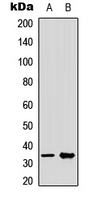 Western blot analysis of CRSP8 expression in Jurkat (A); Hela (B) whole cell lysates.