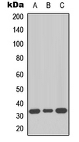 Western blot analysis of MKI67IP expression in HeLa (A); SW480 (B); HepG2 (C) whole cell lysates.