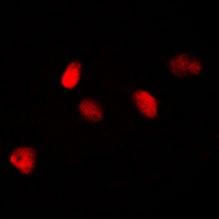 Immunofluorescent analysis of MKI67IP staining in HeLa cells. Formalin-fixed cells were permeabilized with 0.1% Triton X-100 in TBS for 5-10 minutes and blocked with 3% BSA-PBS for 30 minutes at room temperature. Cells were probed with the primary antibody in 3% BSA-PBS and incubated overnight at 4 deg C in a hidified chamber. Cells were washed with PBST and incubated with a DyLight 594-conjugated secondary antibody (red) in PBS at room temperature in the dark. DAPI was used to stain the cell nuclei (blue).
