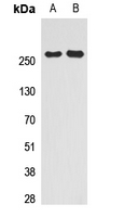 Western blot analysis of SMRT expression in HeLa (A); HEK293T (B) whole cell lysates.