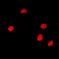 Immunofluorescent analysis of SMRT staining in HeLa cells. Formalin-fixed cells were permeabilized with 0.1% Triton X-100 in TBS for 5-10 minutes and blocked with 3% BSA-PBS for 30 minutes at room temperature. Cells were probed with the primary antibody in 3% BSA-PBS and incubated overnight at 4 deg C in a hidified chamber. Cells were washed with PBST and incubated with a DyLight 594-conjugated secondary antibody (red) in PBS at room temperature in the dark. DAPI was used to stain the cell nuclei (blue).
