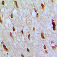 Immunohistochemical analysis of NFAT5 staining in human brain formalin fixed paraffin embedded tissue section. The section was pre-treated using heat mediated antigen retrieval with sodium citrate buffer (pH 6.0). The section was then incubated with the antibody at room temperature and detected using an HRP conjugated compact polymer system. DAB was used as the chromogen. The section was then counterstained with haematoxylin and mounted with DPX.