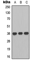 Western blot analysis of GPR86 expression in HeLa (A); Juakat (B); HuvEc (C) whole cell lysates.