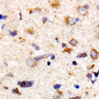 Immunohistochemical analysis of MYPT1 (pT853) staining in human brain formalin fixed paraffin embedded tissue section. The section was pre-treated using heat mediated antigen retrieval with sodium citrate buffer (pH 6.0). The section was then incubated with the antibody at room temperature and detected using an HRP conjugated compact polymer system. DAB was used as the chromogen. The section was then counterstained with haematoxylin and mounted with DPX.