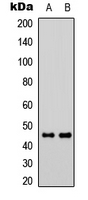 Western blot analysis of GPR73a expression in Jurkat (A); Raw264.7 (B) whole cell lysates.