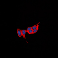 Immunofluorescent analysis of GPR73a staining in Jurkat cells. Formalin-fixed cells were permeabilized with 0.1% Triton X-100 in TBS for 5-10 minutes and blocked with 3% BSA-PBS for 30 minutes at room temperature. Cells were probed with the primary antibody in 3% BSA-PBS and incubated overnight at 4 deg C in a hidified chamber. Cells were washed with PBST and incubated with a DyLight 594-conjugated secondary antibody (red) in PBS at room temperature in the dark. DAPI was used to stain the cell nuclei (blue).