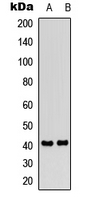 Western blot analysis of IP Receptor expression in HeLa (A); rat brain (B) whole cell lysates.