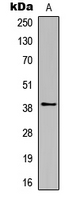 Western blot analysis of Rhodopsin expression in HL60 (A) whole cell lysates.