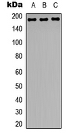Western blot analysis of Zep-1 expression in HeLa (A); NIH3T3 (B); rat brain (C) whole cell lysates.