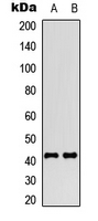 Western blot analysis of SSTR4 expression in HEK293T (A); NIH3T3 (B) whole cell lysates.