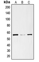 Western blot analysis of ENT1 expression in SKNSH (A); mouse heart (B); rat heart (C) whole cell lysates.