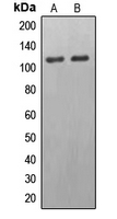 Western blot analysis of EPB41L2 expression in HeLa (A); HepG2 (B) whole cell lysates.