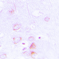 Immunohistochemical analysis of EPB41L2 staining in human brain formalin fixed paraffin embedded tissue section. The section was pre-treated using heat mediated antigen retrieval with sodium citrate buffer (pH 6.0). The section was then incubated with the antibody at room temperature and detected using an HRP conjugated compact polymer system. DAB was used as the chromogen. The section was then counterstained with haematoxylin and mounted with DPX.