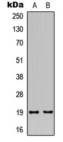 Western blot analysis of TUSC5 expression in human heart (A); rat heart (B) whole cell lysates.