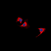 Immunofluorescent analysis of TUSC5 staining in HeLa cells. Formalin-fixed cells were permeabilized with 0.1% Triton X-100 in TBS for 5-10 minutes and blocked with 3% BSA-PBS for 30 minutes at room temperature. Cells were probed with the primary antibody in 3% BSA-PBS and incubated overnight at 4 deg C in a hidified chamber. Cells were washed with PBST and incubated with a DyLight 594-conjugated secondary antibody (red) in PBS at room temperature in the dark. DAPI was used to stain the cell nuclei (blue).