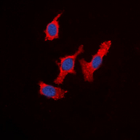 Immunofluorescent analysis of WASF1 staining in HeLa cells. Formalin-fixed cells were permeabilized with 0.1% Triton X-100 in TBS for 5-10 minutes and blocked with 3% BSA-PBS for 30 minutes at room temperature. Cells were probed with the primary antibody in 3% BSA-PBS and incubated overnight at 4 deg C in a hidified chamber. Cells were washed with PBST and incubated with a DyLight 594-conjugated secondary antibody (red) in PBS at room temperature in the dark. DAPI was used to stain the cell nuclei (blue).