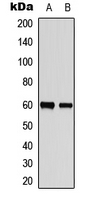 Western blot analysis of NIPA (pS354) expression in HepG2 (A); human testis (B) whole cell lysates.