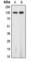 Western blot analysis of EPHA5 expression in SKNSH (A); A549 (B) whole cell lysates.