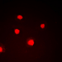 Immunofluorescent analysis of NIPA (pS354) staining in HepG2 cells. Formalin-fixed cells were permeabilized with 0.1% Triton X-100 in TBS for 5-10 minutes and blocked with 3% BSA-PBS for 30 minutes at room temperature. Cells were probed with the primary antibody in 3% BSA-PBS and incubated overnight at 4 deg C in a hidified chamber. Cells were washed with PBST and incubated with a DyLight 594-conjugated secondary antibody (red) in PBS at room temperature in the dark. DAPI was used to stain the cell nuclei (blue).