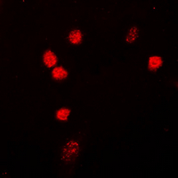 Immunofluorescent analysis of NIPA staining in HepG2 cells. Formalin-fixed cells were permeabilized with 0.1% Triton X-100 in TBS for 5-10 minutes and blocked with 3% BSA-PBS for 30 minutes at room temperature. Cells were probed with the primary antibody in 3% BSA-PBS and incubated overnight at 4 deg C in a hidified chamber. Cells were washed with PBST and incubated with a DyLight 594-conjugated secondary antibody (red) in PBS at room temperature in the dark. DAPI was used to stain the cell nuclei (blue).
