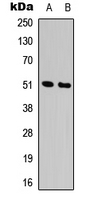 Western blot analysis of Alpha-1A Adrenergic Receptor expression in HepG2 (A); K562 (B) whole cell lysates.