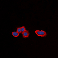 Immunofluorescent analysis of Alpha-1A Adrenergic Receptor staining in HepG2 cells. Formalin-fixed cells were permeabilized with 0.1% Triton X-100 in TBS for 5-10 minutes and blocked with 3% BSA-PBS for 30 minutes at room temperature. Cells were probed with the primary antibody in 3% BSA-PBS and incubated overnight at 4 deg C in a hidified chamber. Cells were washed with PBST and incubated with a DyLight 594-conjugated secondary antibody (red) in PBS at room temperature in the dark. DAPI was used to stain the cell nuclei (blue).