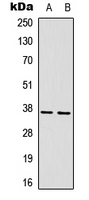 Western blot analysis of CD296 expression in HepG2 (A); mouse brain (B) whole cell lysates.