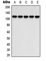 Western blot analysis of ATP1A2 expression in K562 (A); HepG2 (B); NIH3T3 (C); mouse brain (D); COS7 (E) whole cell lysates.
