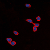 Immunofluorescent analysis of Cadherin 24 staining in SHSY5Y cells. Formalin-fixed cells were permeabilized with 0.1% Triton X-100 in TBS for 5-10 minutes and blocked with 3% BSA-PBS for 30 minutes at room temperature. Cells were probed with the primary antibody in 3% BSA-PBS and incubated overnight at 4 deg C in a hidified chamber. Cells were washed with PBST and incubated with a DyLight 594-conjugated secondary antibody (red) in PBS at room temperature in the dark. DAPI was used to stain the cell nuclei (blue).