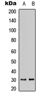 Western blot analysis of DHRS11 expression in MCF7 (A); mouse kidney (B) whole cell lysates.